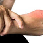 BoneJoint_arthritis