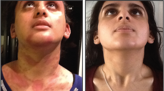 Skin Health