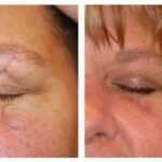 skincare2