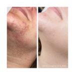 skincare3