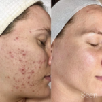 skincare4
